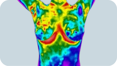 img-termografia