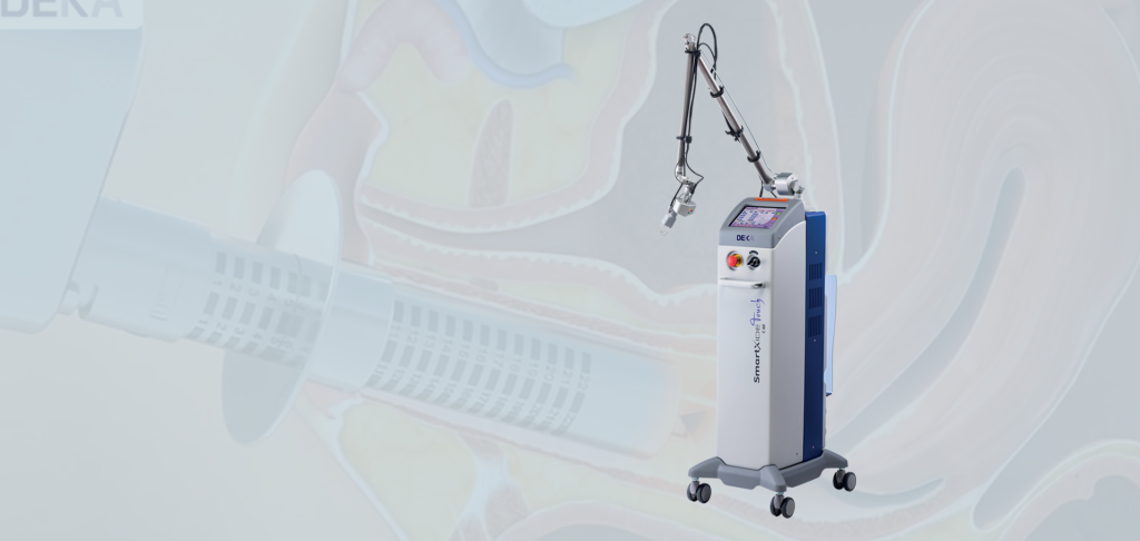 Laser CO₂ Monalisa Touch (laser íntimo) 5 Laser CO2 Teresina